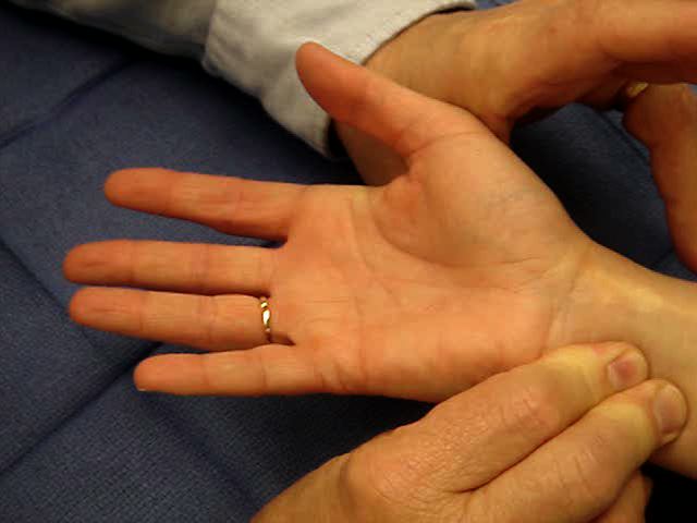 Allen Test Hand Surgery Resource